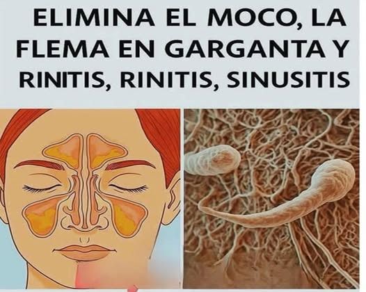Acumulación de moco en cavidades nasales