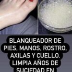 Remedios Caseros para Blanquear Axilas, Rodillas y Codos