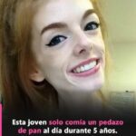 De la Anorexia a la Fuerza: La Inspiradora Historia de Annie Windley