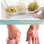 Alfalfa: Tu Aliada Natural para la Gota y la Salud Renal