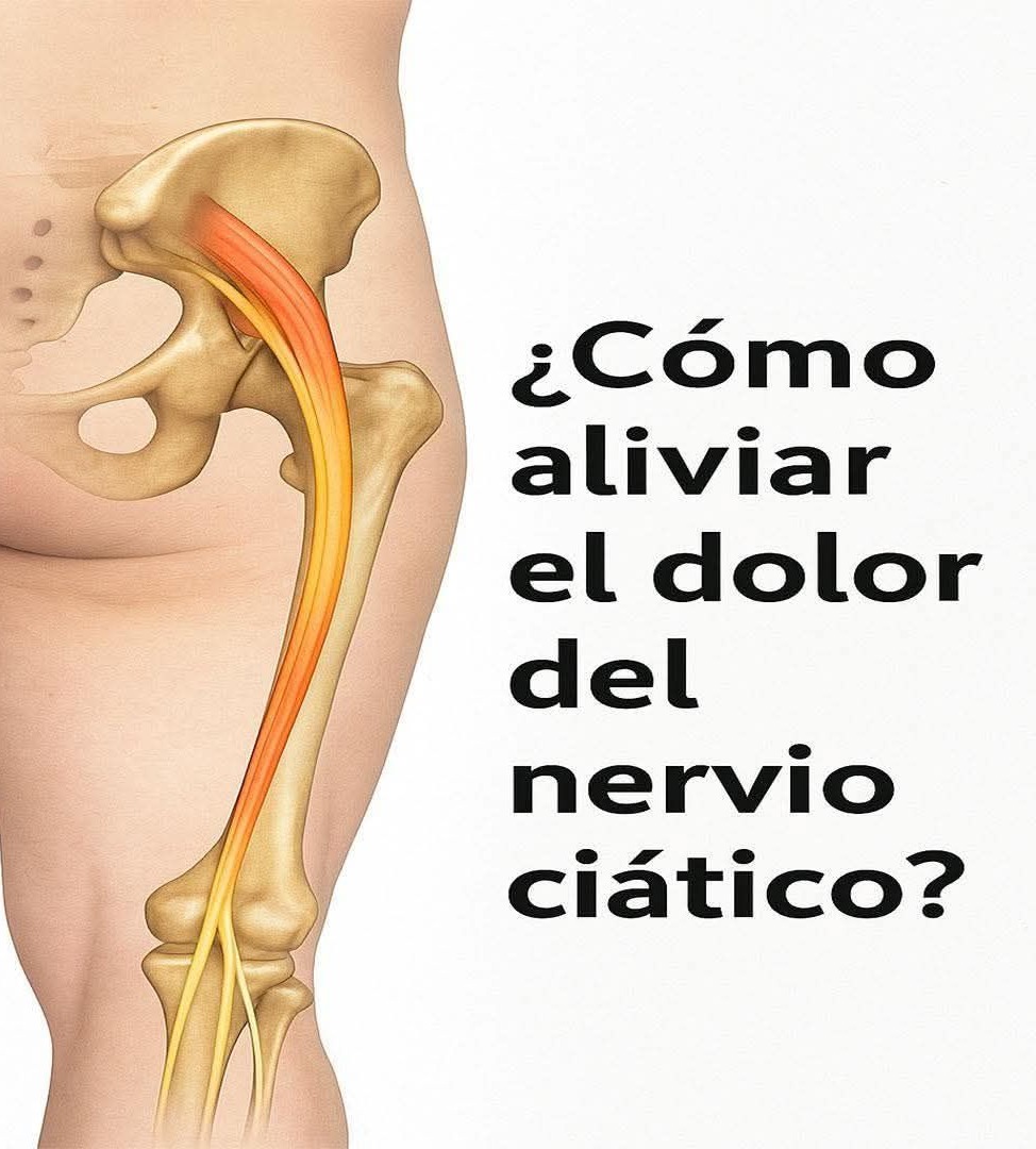 Ilustración del nervio ciático