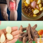 Remedios Naturales para Aliviar el Dolor de Piernas y Problemas Articulares