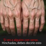 Causas de las Venas Visibles en las Manos y Cómo Manejarlo
