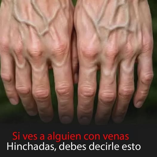Manos con venas visibles