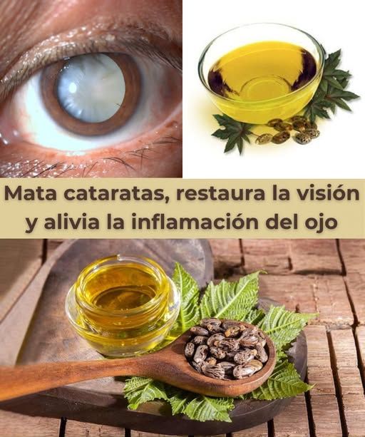 Remedio Natural para Cataratas - Ingredientes