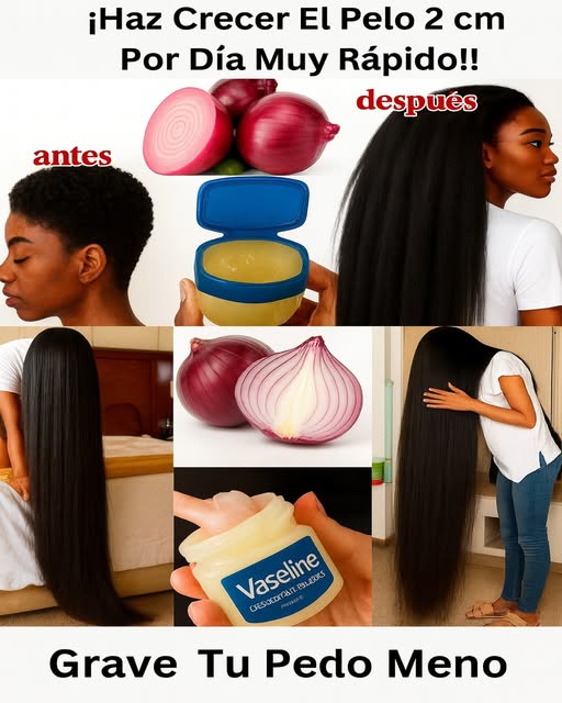 Método viral para hacer crecer el cabello