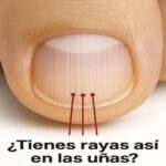 Signos de Salud en tus Uñas: ¿Sabías que las Rayas Reflejan tu Bienestar?