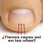 Rayas en las Uñas: Un Reflejo de Tu Salud