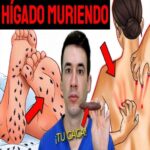 Señales Tempranas de Daño Hepático: Cuidado y Remedios Naturales