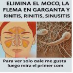 Elimina el Moco y la Flema: Remedios Caseros para Problemas Respiratorios