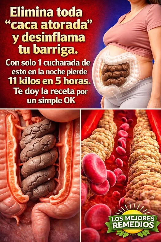 Remedios Naturales para el Abdomen Inflamado