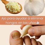 El Ajo: Tu Aliado Natural para Combatir los Hongos en las Uñas