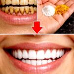 Blanquea tus Dientes en Solo 2 Minutos con Recursos Naturales