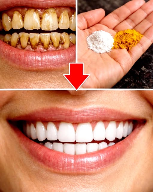 Dientes blancos gracias a ingredientes naturales