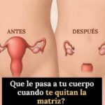 Efectos Secundarios de la Histerectomía: Lo Que Cada Mujer Debe Saber