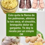 Remedios Naturales para problemas Respiratorios: Elimina la Tos Seca y la Flema