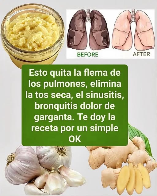 Remedio natural para problemas respiratorios