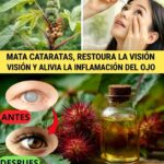 Cómo Combatir las Cataratas y Aliviar la Inflamación Ocular de Forma Natural