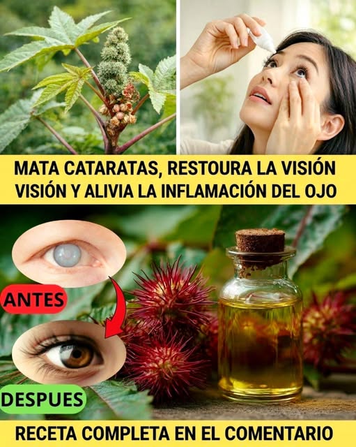 Remedio Natural para Cataratas