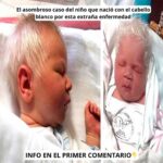 El Asombroso Caso del Niño que Nació con Cabello Blanco: Un Acontecimiento Único