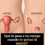 ¿Qué Sucede Realmente Cuando Te Quitan la Matriz? Todo lo que Debes Saber