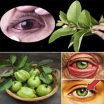 Cómo Usar la Guayaba para Tratar Problemas Oculares