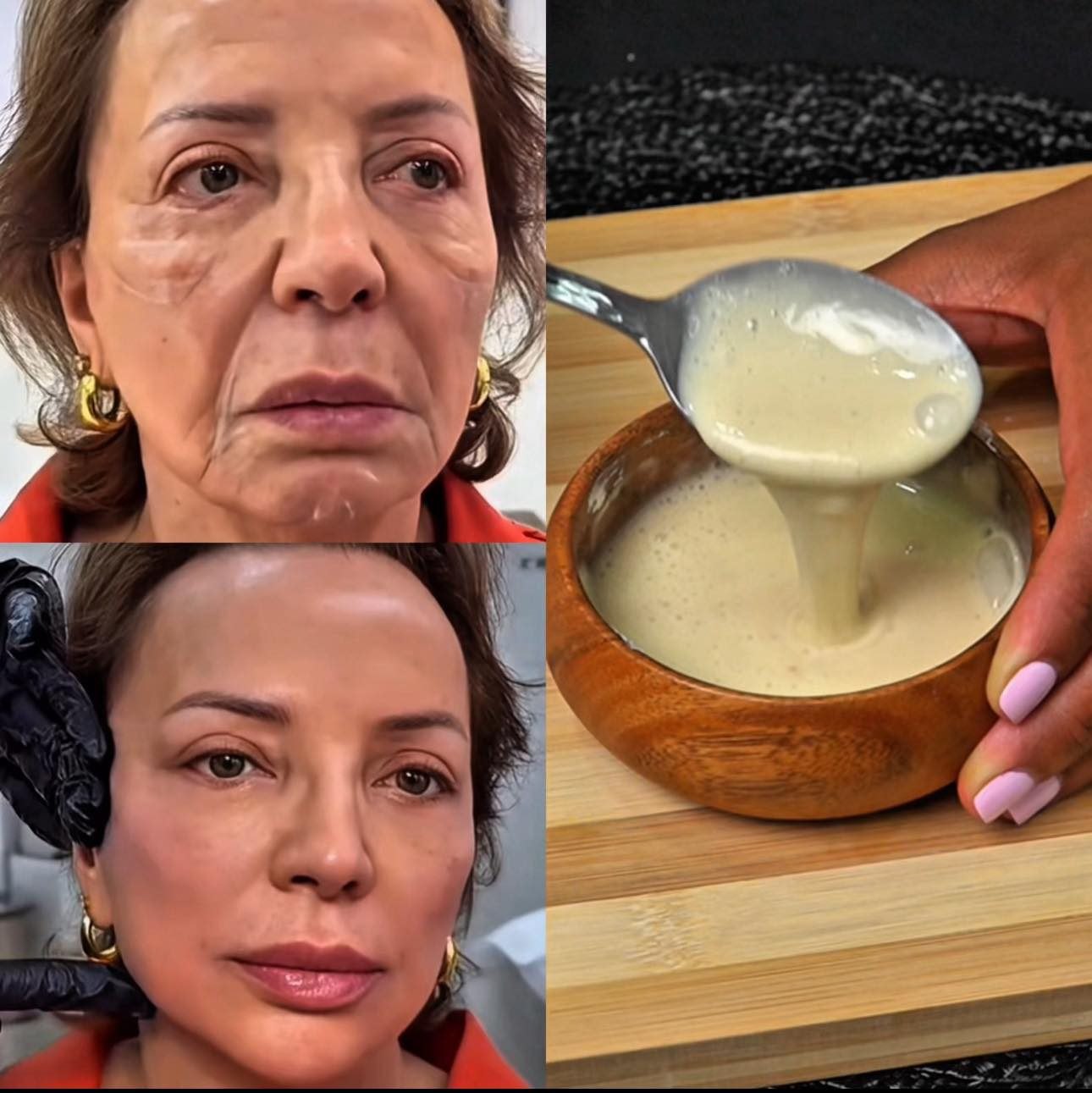 Antes y después de tratamiento de piel