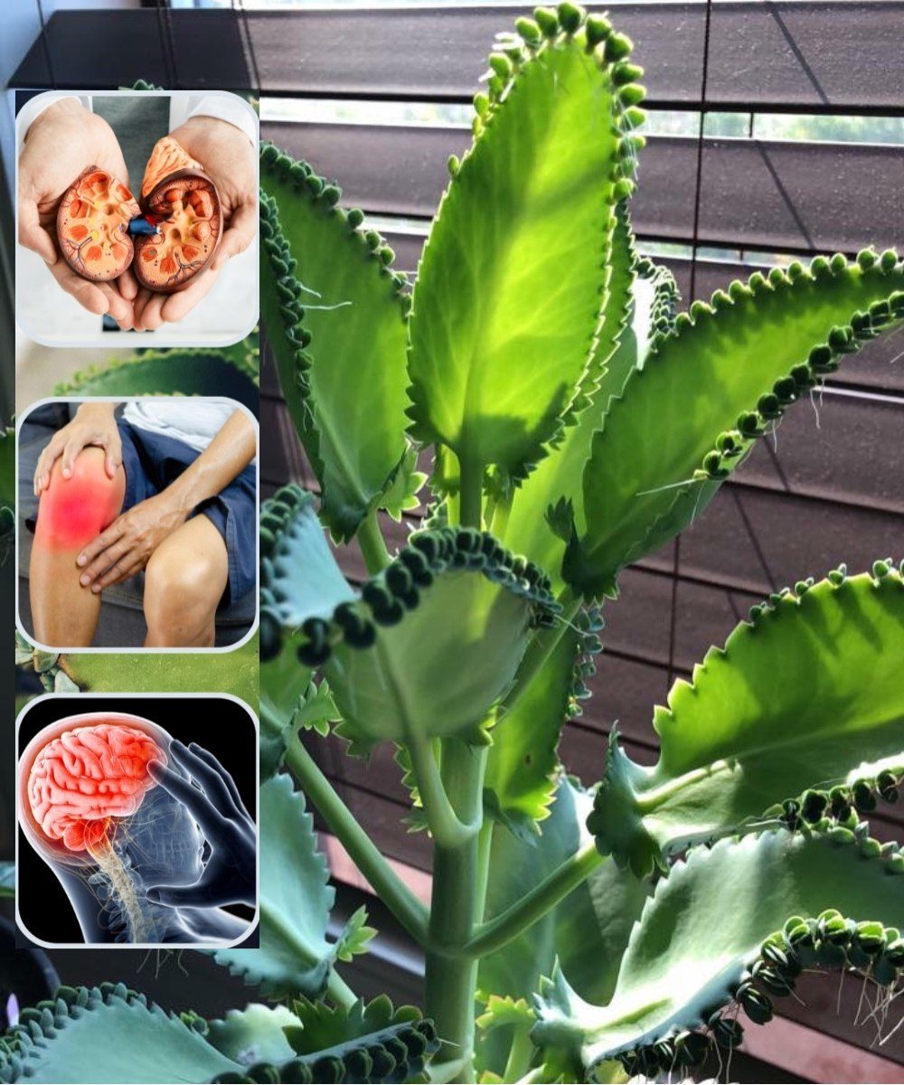 Beneficios del Kalanchoe