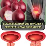 Recetas Naturales para la Vejiga y Próstata: Beneficios de la Cebolla
