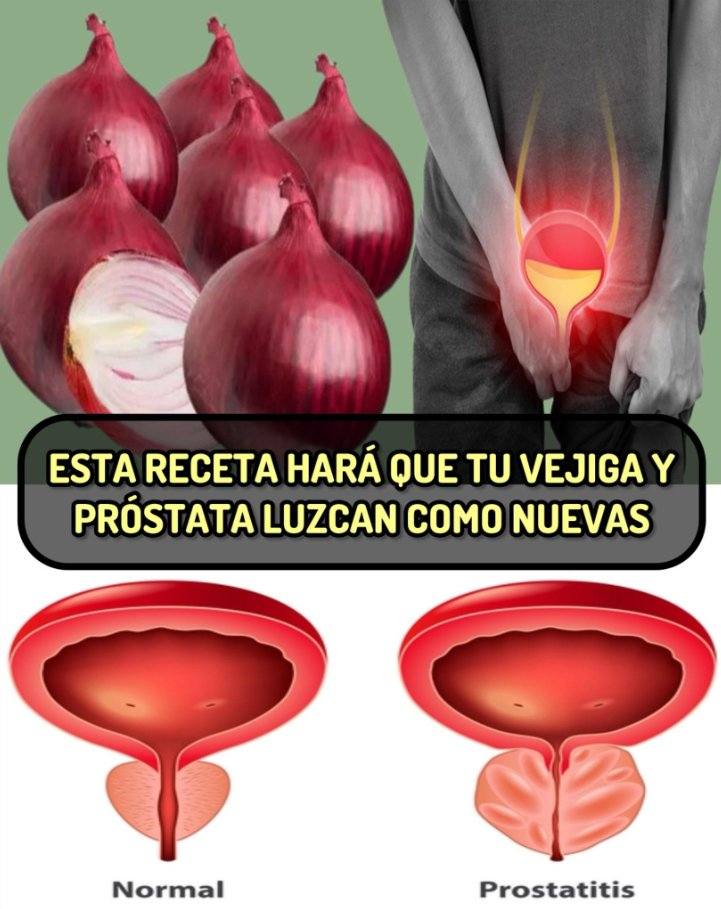 Beneficios de la Cebolla para la salud