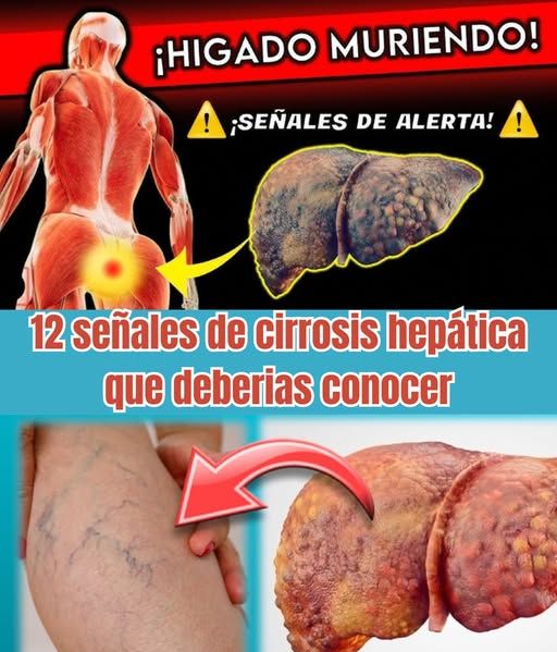 Esquema del hígado humano